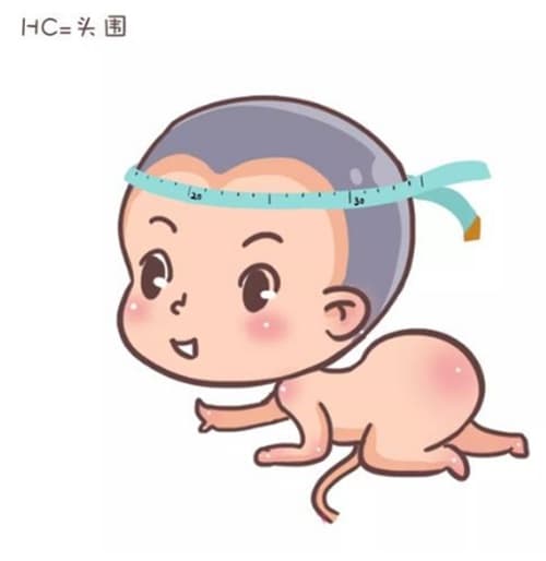 新生儿30天体检项目