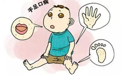 新生儿拉肚子是怎么回事