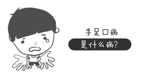 手足口病会复发吗