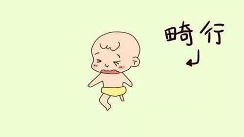 怎么检查胎儿是否畸形