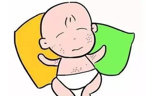 新生儿热疹怎么消下去