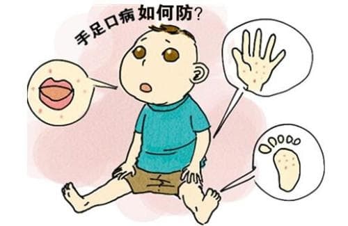 手足口病什么季节多见