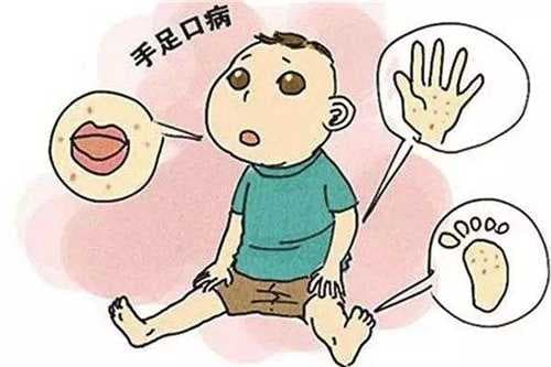 小儿手足口病是怎么引起的