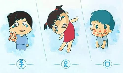 手足口病潜伏期多久